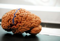 Elon Musk obtient 27 millions de dollars pour financer les activités de Neuralink