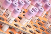 Health Data Hub : la France interdit le transfert de données de santé hors de l'Union européenne