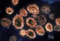 Coronavirus : vous évitez le médecin ? Vous pouvez signaler votre état pour aider...