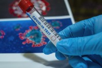 Coronavirus : pourquoi la quatorzaine va être raccourcie à 7 jours en France