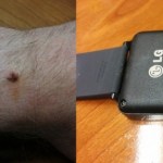 #corrosiongate : les connecteurs de la LG G Watch responsables de brûlures ?