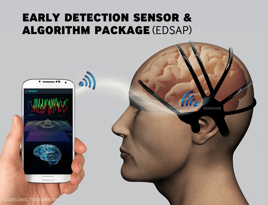 EDSAP samsung capteur cerebral avc