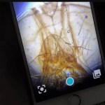 Transformez votre smartphone en microscope avec DIPLE, un accessoire Kickstarté
