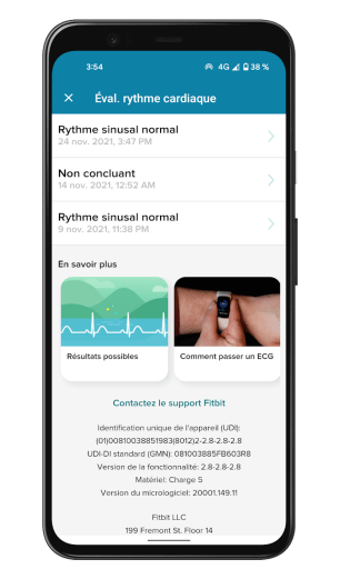Fitbit Charge 5 - ECG App (2)