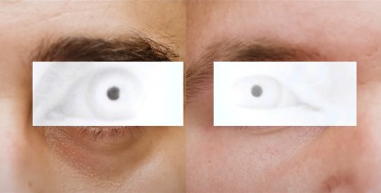 Les mêmes yeux, cette fois sous une lumière infrarouge // Source : The Verge