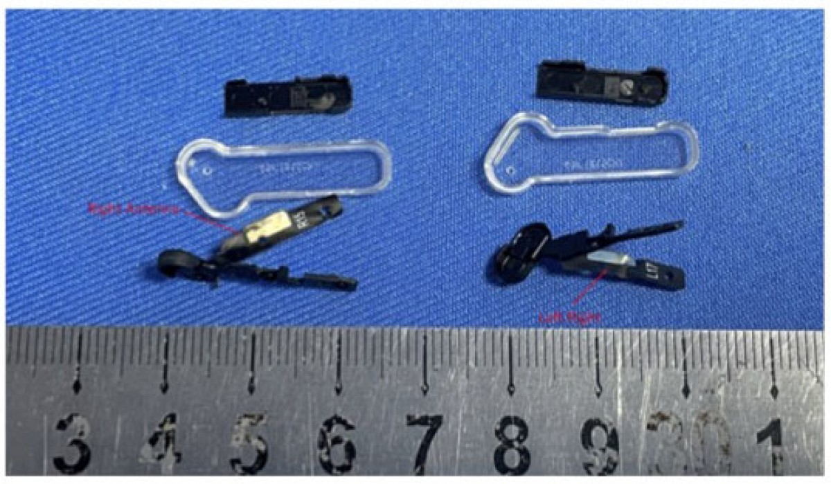 Nothing ear (Stick) antennas
