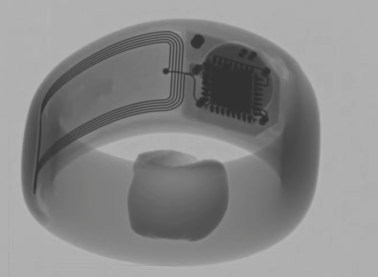 Scan de la bague Aeklys