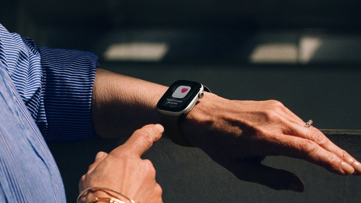 L'Apple Watch Series 11