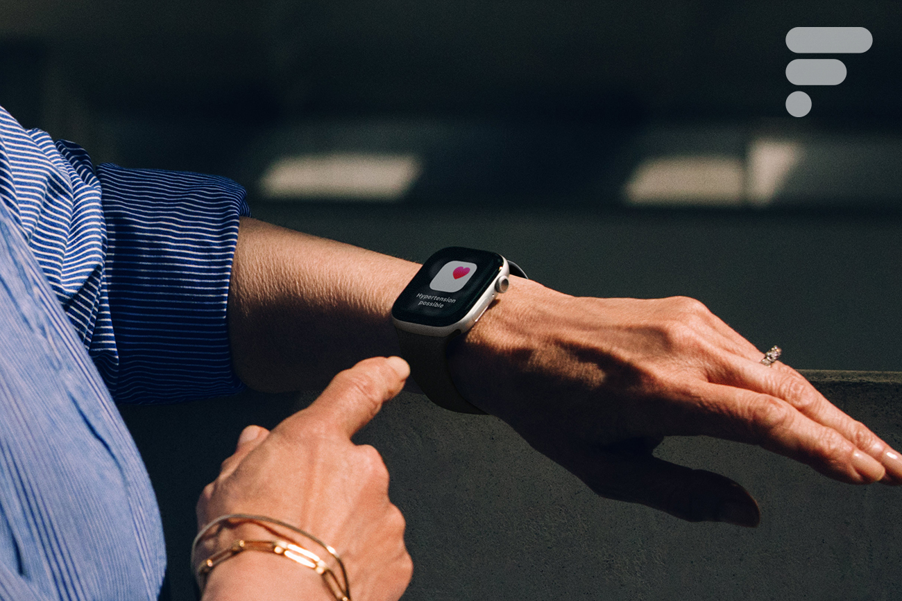 L'Apple Watch Series 11
