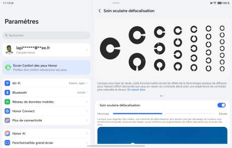 Captura de tela_20260225_111319_com_hihonor_eyesense_DefocusActivity Captura de tela_20260225_111319_com_hihonor_eyesense_DefocusActivity