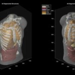 Midjourney, le générateur d&rsquo;images, promet un scan « comparable à l&rsquo;IRM » via ultrasons et IA
