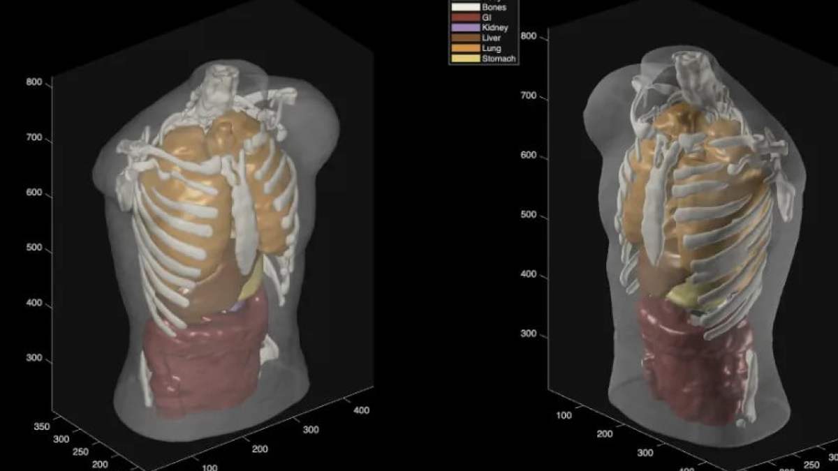 Midjourney, le générateur d’images, promet un scan « comparable à l’IRM » via ultrasons et IA