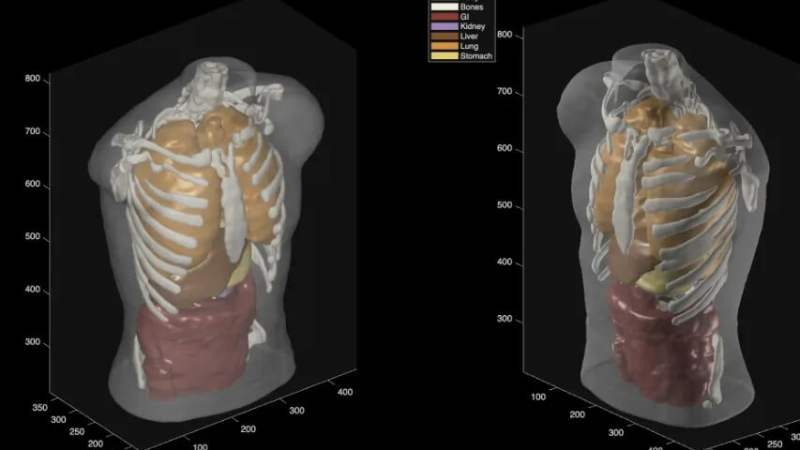 Midjourney, le générateur d’images, promet un scan « comparable à l’IRM » via ultrasons et IA