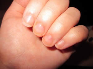 ongles La cuticule pauvre, l'ongle court... c'est la lose