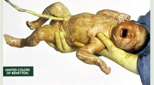 Crédits : Oliviero Toscani Crédits : Oliviero Toscani