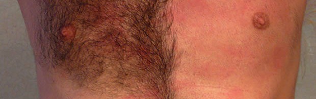 torse torse