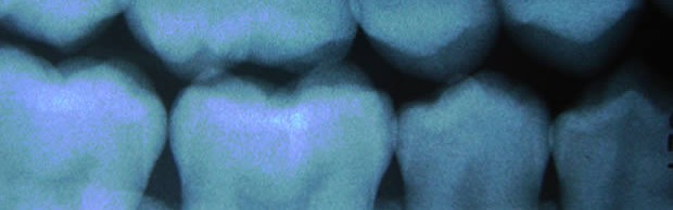 dents dents