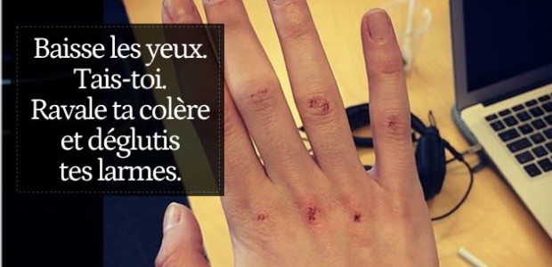 big-colere-harcelement-agression-sexuelle big-colere-harcelement-agression-sexuelle