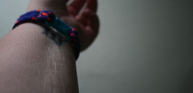 scars scars