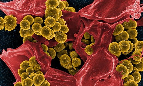 jvc-bacteria-teaming
