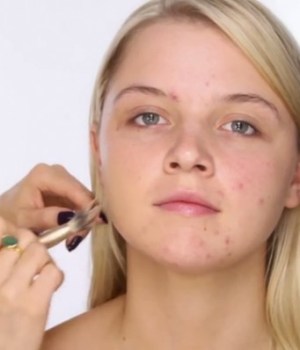 tutos-maquillage-acne