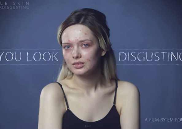 you-look-disgusting-video-acne-youtubeuse