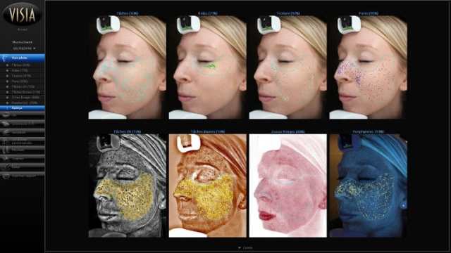 diagnostic-visia diagnostic-visia