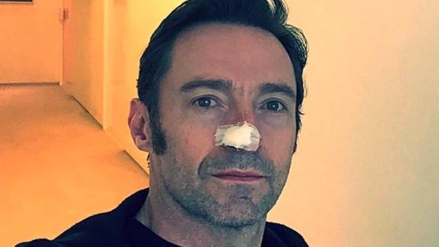 hugh-jackman-sensibilisation-creme-solaire