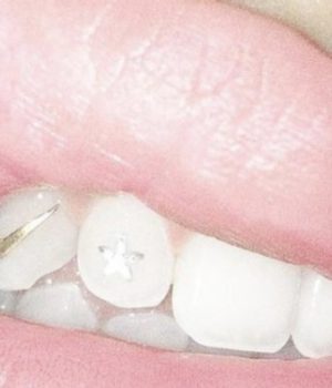 tendance-bijoux-dents-2017