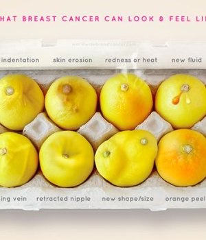cancer-seins-citrons