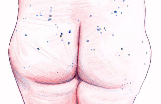 fesses-mymy fesses-mymy