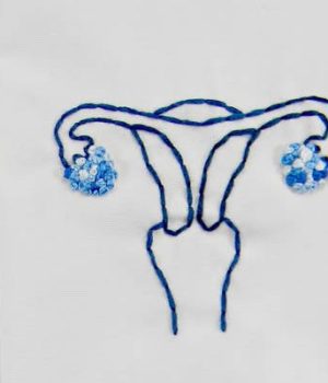 cancer-col-uterus-vaccination-australie cancer-col-uterus-vaccination-australie