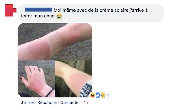 com coup de soleil com coup de soleil