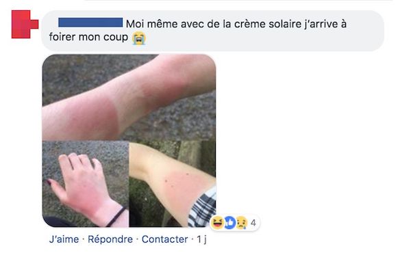 com coup de soleil