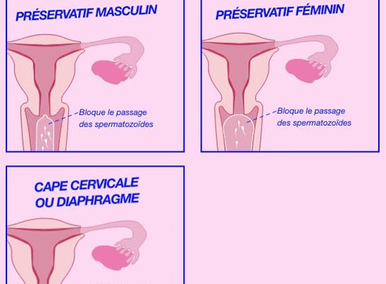 contraceptions-barriere contraceptions-barriere