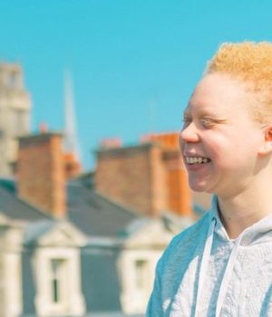 temoignage-jeune-femme-albinos-albinisme
