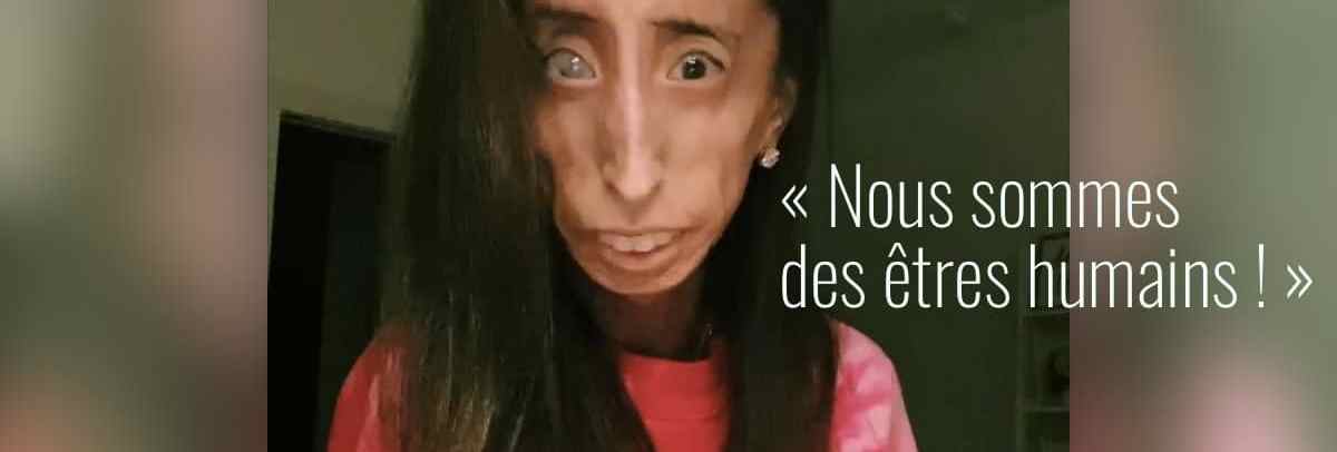L Activiste Handicapee Lizzie Velasquez Reagit A Un Challenge Tiktok Cruel L Activiste Handicapee Lizzie Velasquez Reagit A Un Challenge Tiktok Cruel
