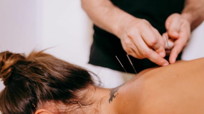 Femme couchée sur le ventre lors d'une séance d'acupuncture.