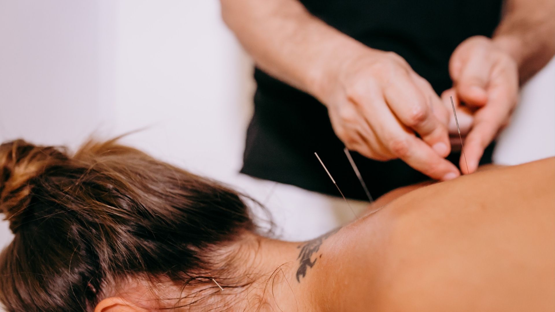 Femme couchée sur le ventre lors d'une séance d'acupuncture.