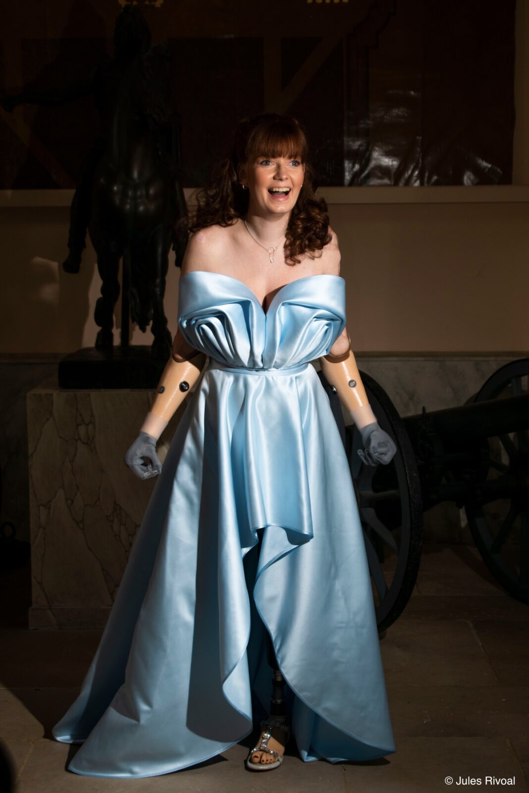 Une femme amputée de plusieurs membres pose en robe bleue. Une femme amputée de plusieurs membres pose en robe bleue.