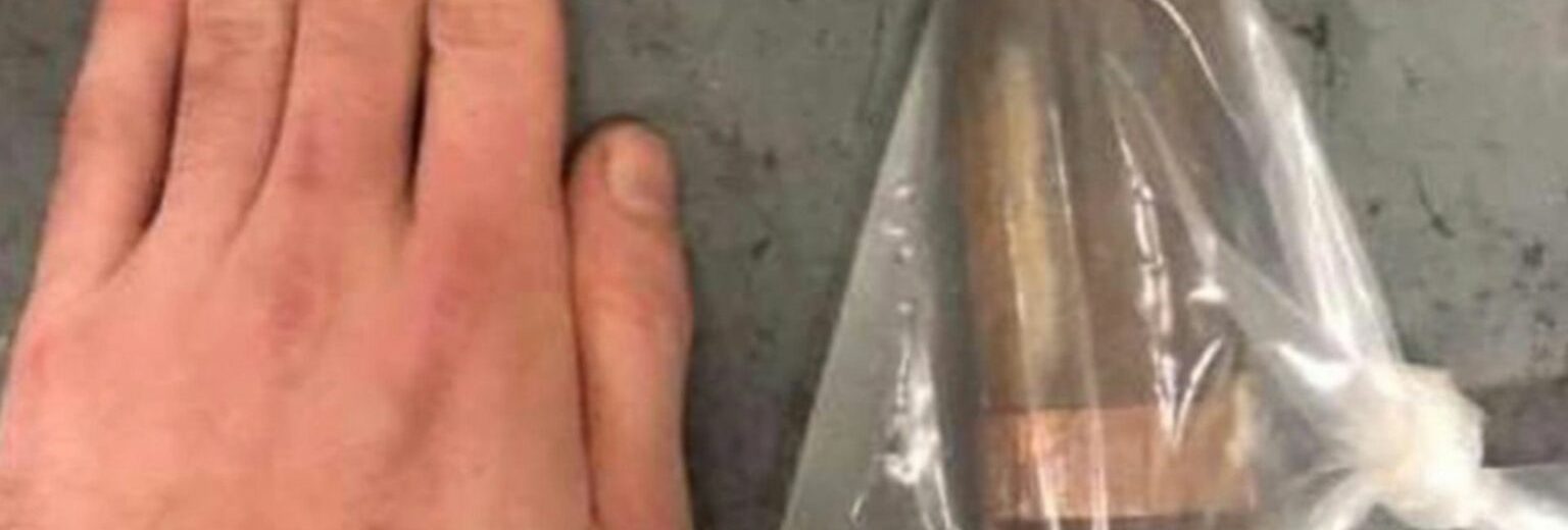 Des démineurs mobilisés pour désarmer un obus coincé dans le rectum d'un patient