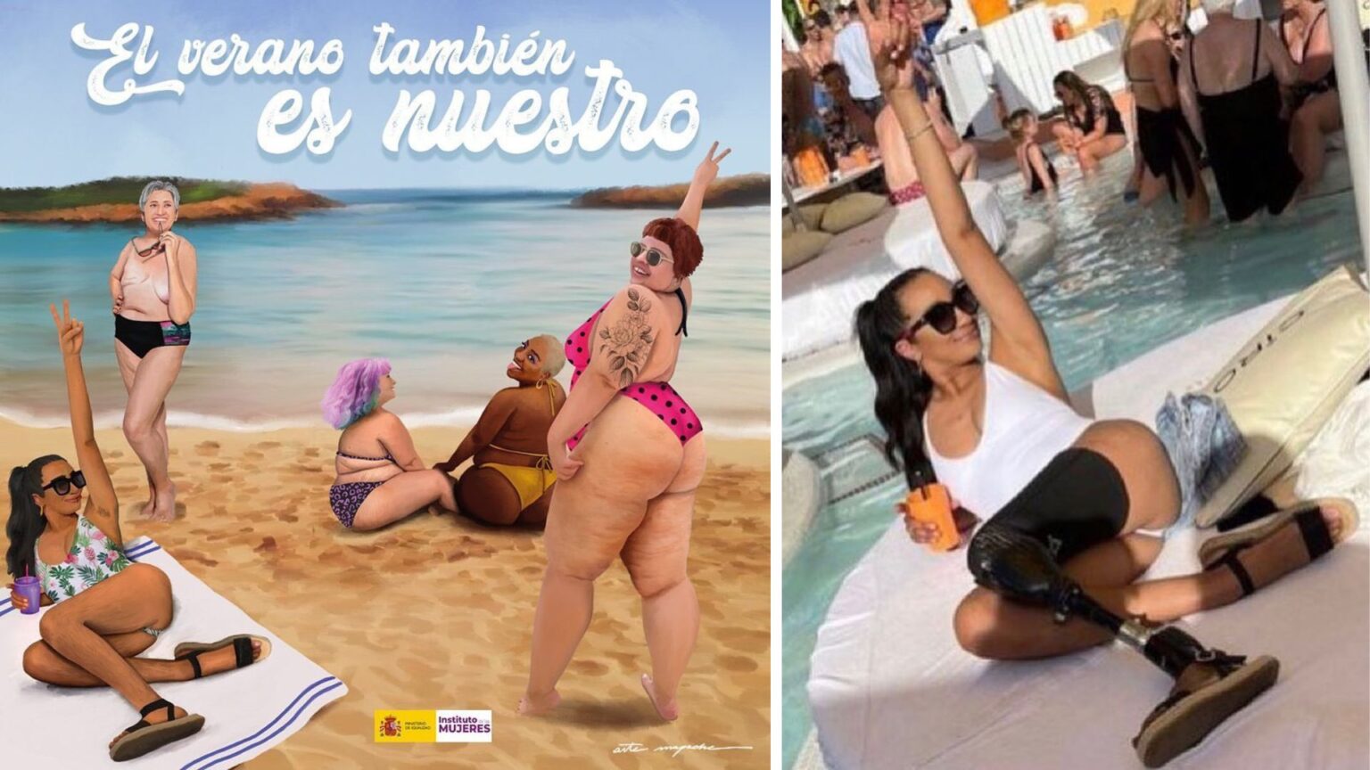 À droite, une publication Instagram de Siân Lord, dont la prothèse a été effacée par l'illustratrice Artemapache