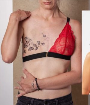Lingerie post-mastectomie où trouver des soutiens-gorges post-opératoire ?