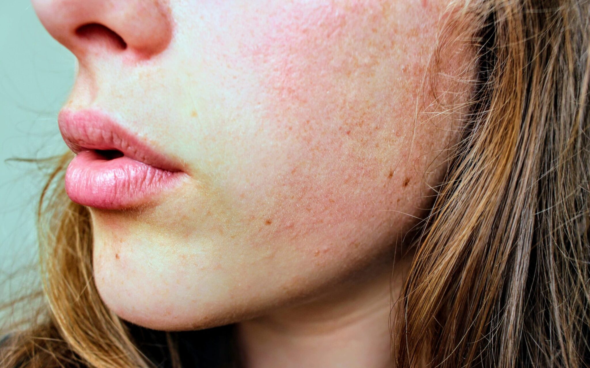 Skin gets dry when you’re sick, but do you know why? Skin gets dry when you’re sick, but do you know why?