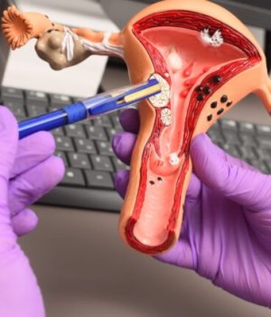 Une modélisation 3D d'utérus entre des mains gantées © Kalinovskiy de la part de Getty Images via Canva