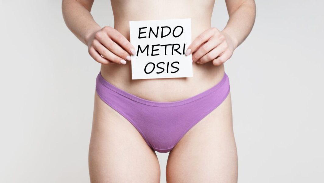 Une femme en culotte violette portant une feuille avec écrit endométriose dessus // Source : axelbueckert