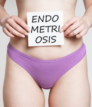Une femme en culotte violette portant une feuille avec écrit endométriose dessus // Source : axelbueckert Une femme en culotte violette portant une feuille avec écrit endométriose dessus // Source : axelbueckert