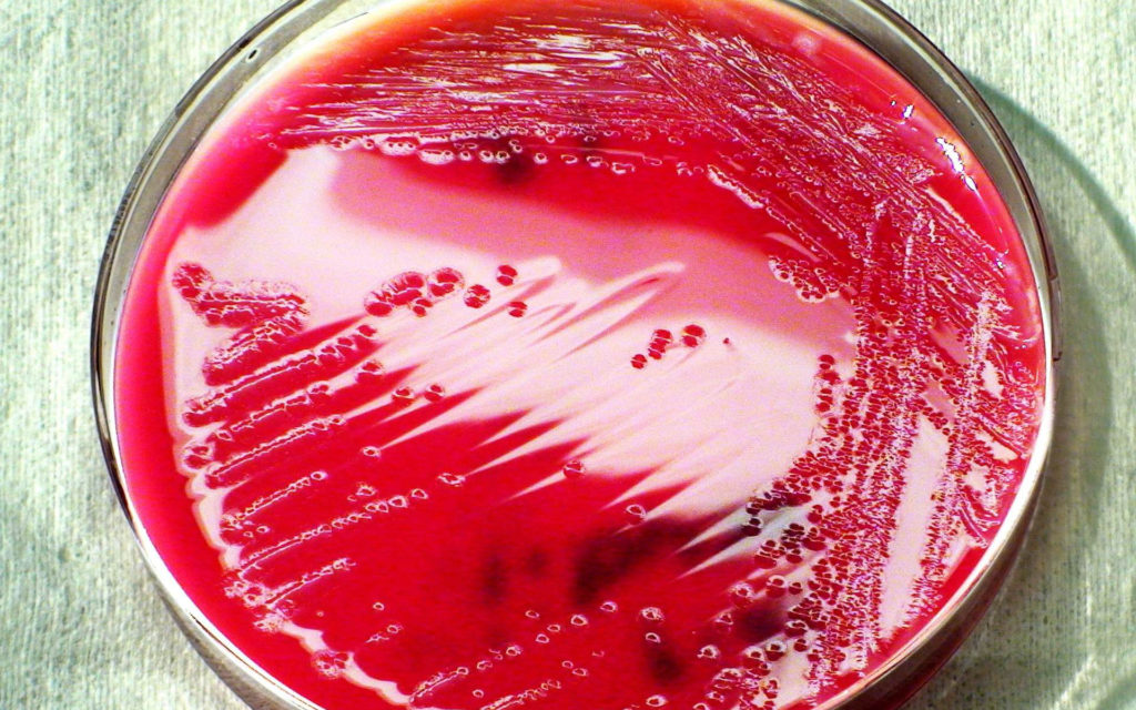 bacterie gram negative rose science medecine sante