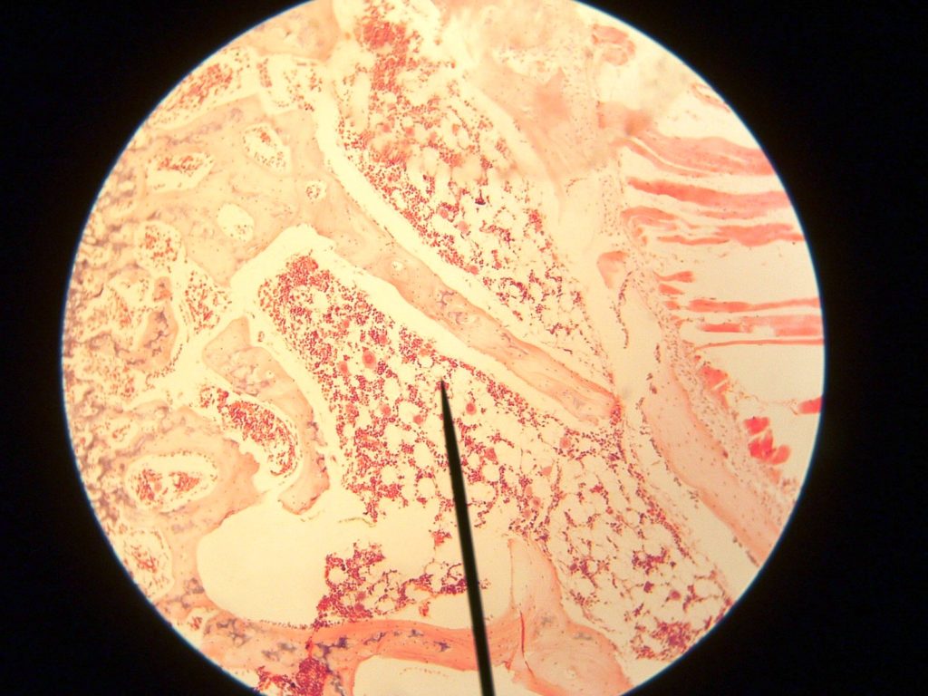 moelle osseuse microscope