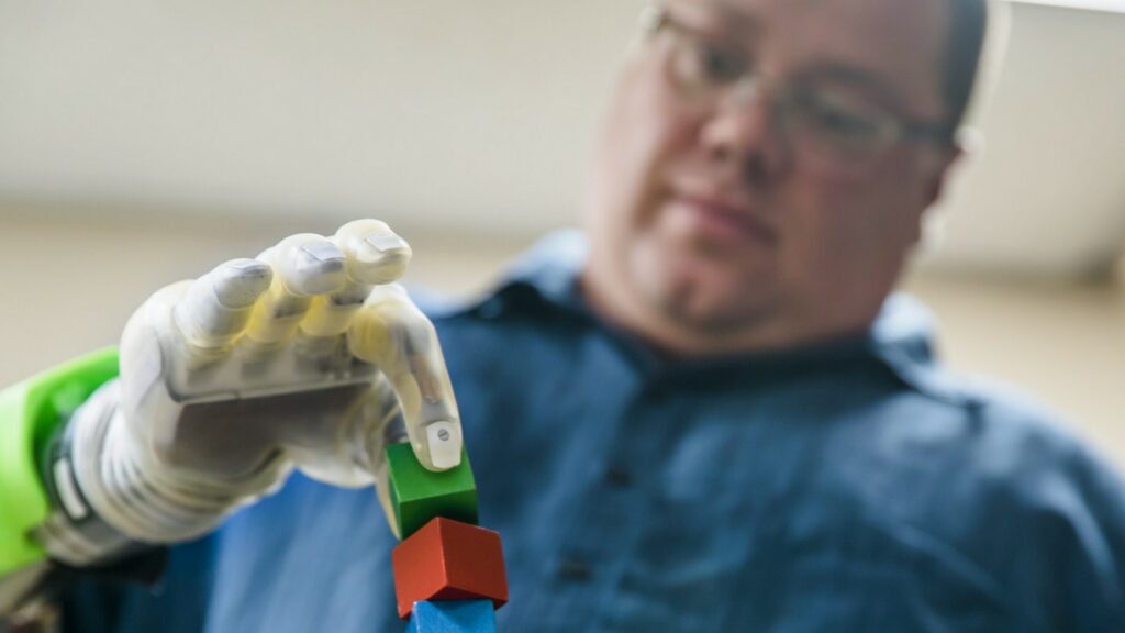 its-like-you-have-a-hand-again-an-ultra-precise-mind-controlled-prosthetic-rpni-1-scaled